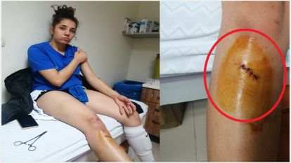 Malatya'nın kadın sporcularına saldırıp, hastanelik ettiler!..