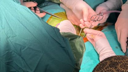 Kalbi Durdu, Beyin Kanaması Geçirdi, Nefesi Kesildi: Acı Dolu 7 Ay