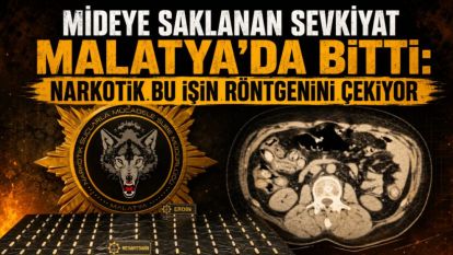 Mideye Saklanan Sevkiyat Malatya'da Bitti: Narkotik Bu İşin Röntgenini Çekiyor